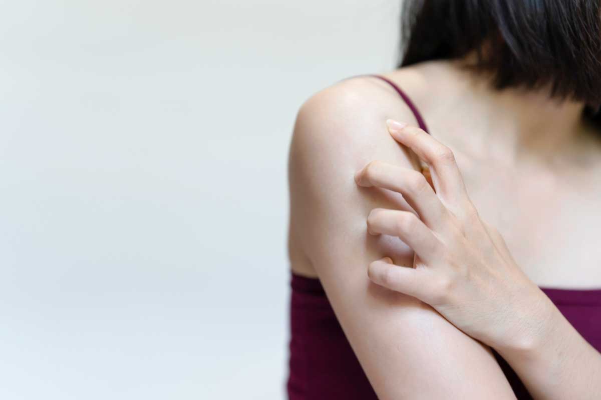 異位性皮膚炎乳液