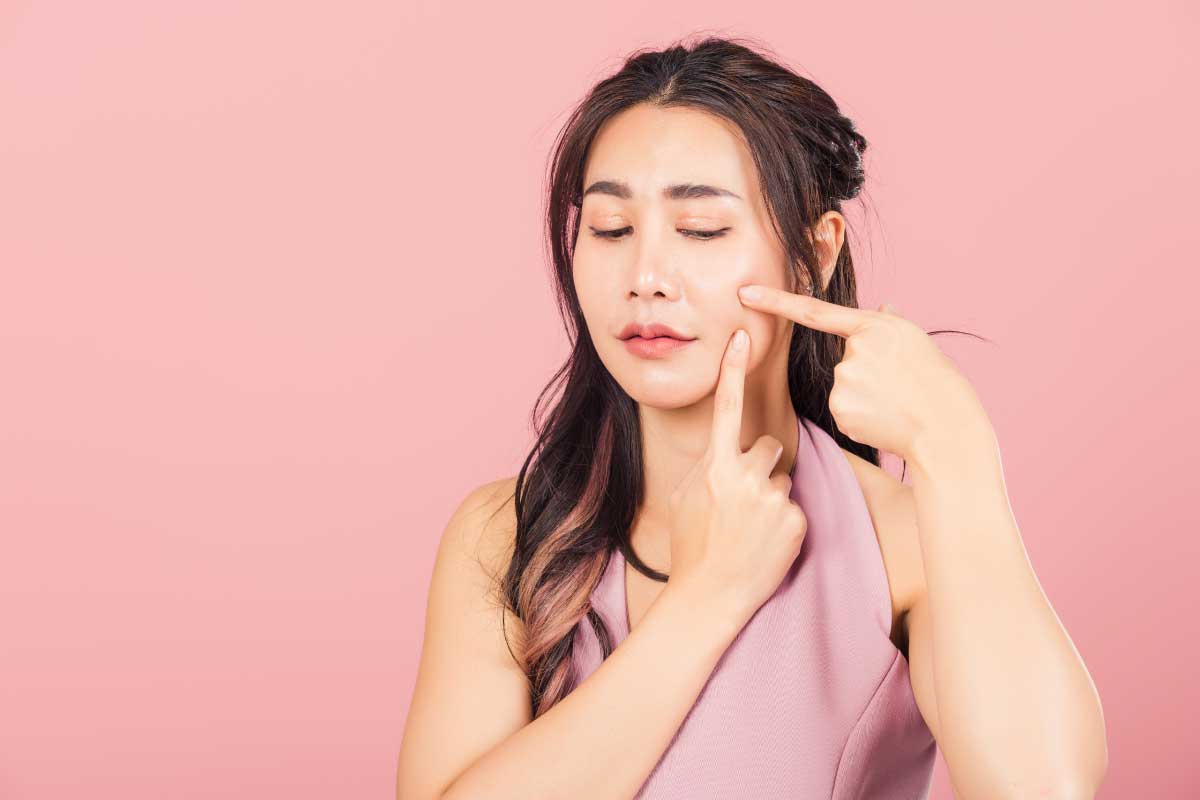 囊腫型痘痘怎麼消